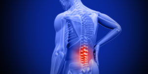 lower back pain Chiropractor Charlotte NC